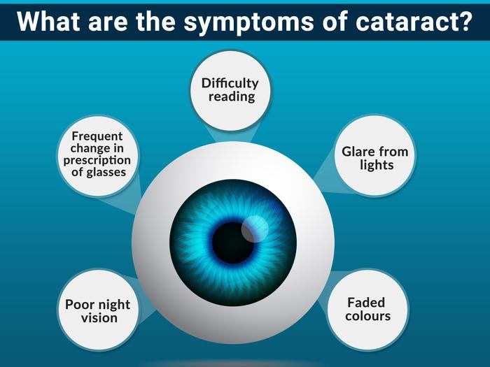 Five essential things you need to understand about cataract surgery